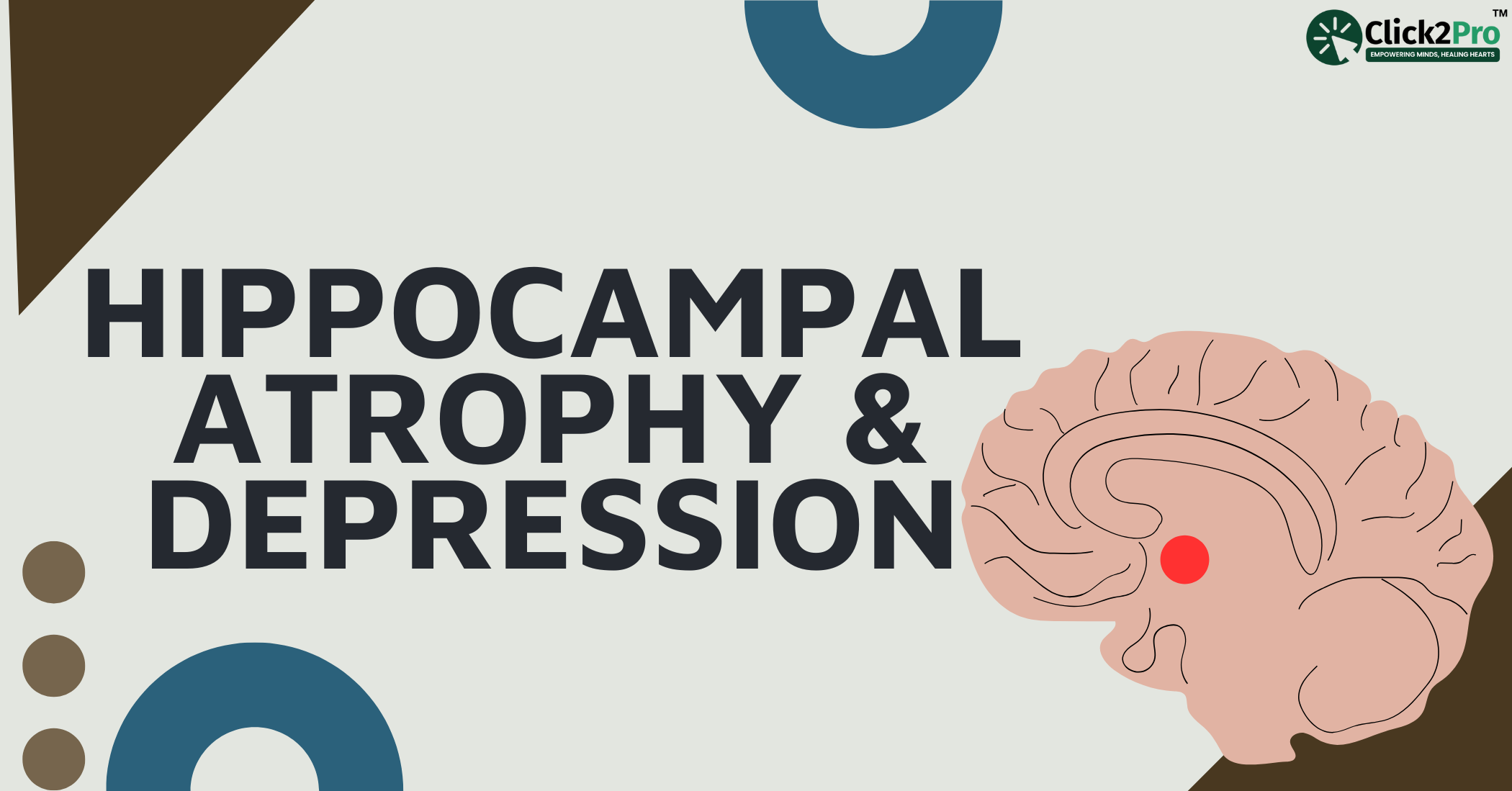 Hippocampal Atrophy and Depression - Brain diagram highlighting hippocampus shrinkage linked to depression.
